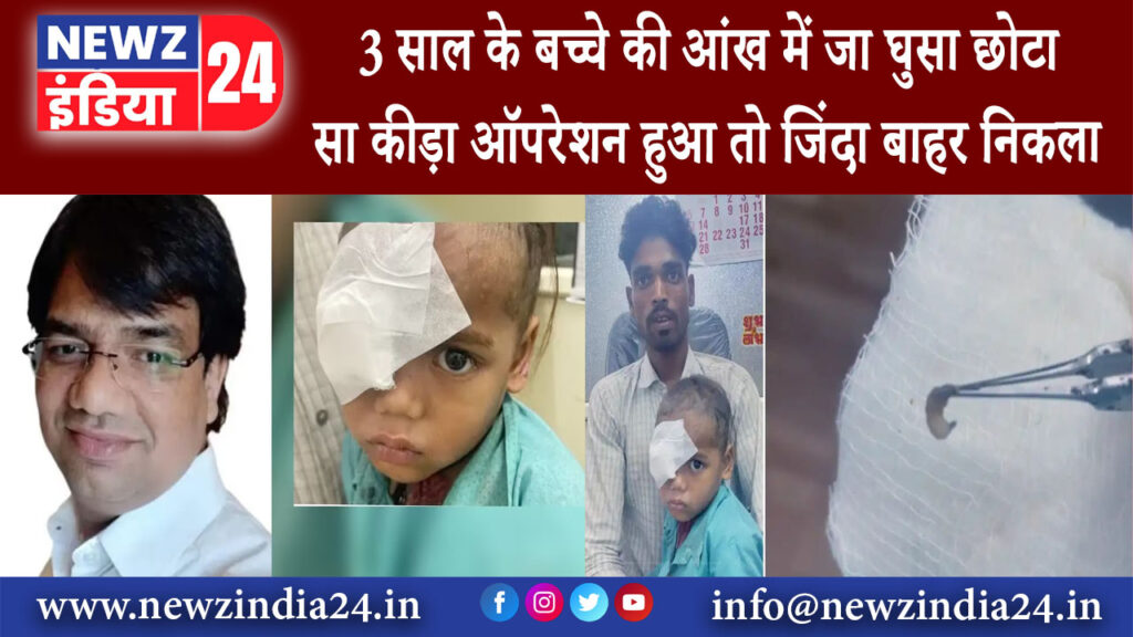 शिवपुरी – 3 साल के बच्चे की आंख में जा घुसा छोटा सा कीड़ा ऑपरेशन हुआ तो जिंदा बाहर निकला