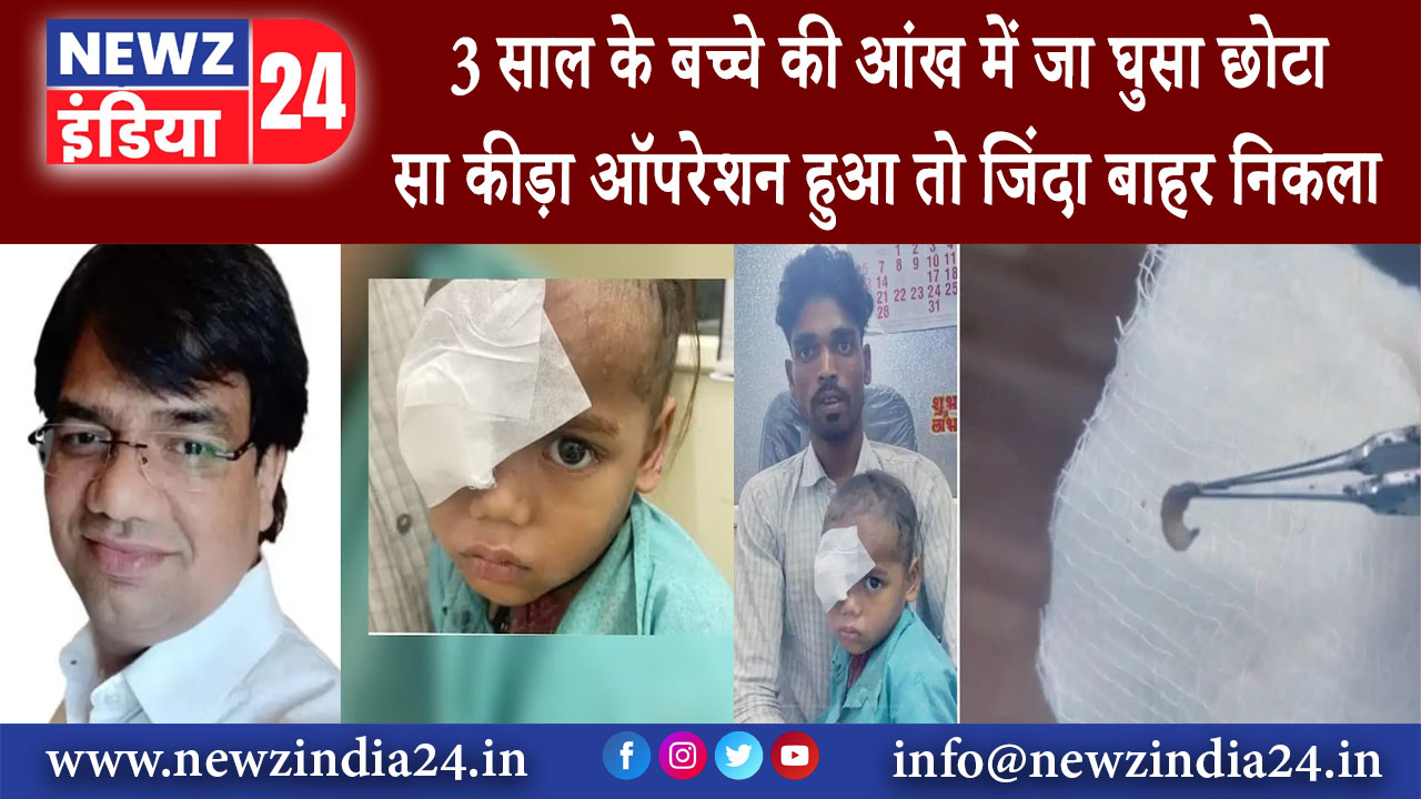 शिवपुरी – 3 साल के बच्चे की आंख में जा घुसा छोटा सा कीड़ा ऑपरेशन हुआ तो जिंदा बाहर निकला