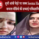 नोएडा – सूजी आंखें, चेहरे पर जख्म Seema Haider ने बताई वायरल वीडियो की सच्चाई पाकिस्तानियों…