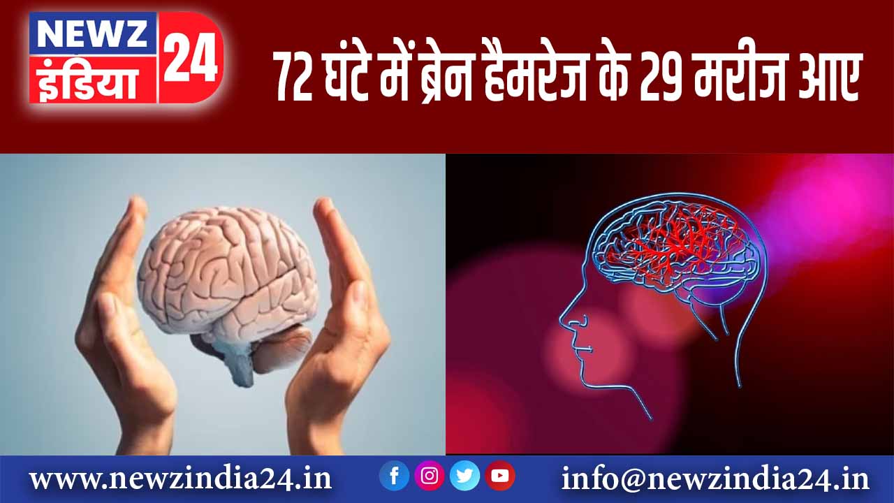 72 घंटे में ब्रेन हैमरेज के 29 मरीज आए