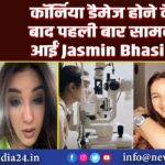 कॉर्निया डैमेज होने के बाद पहली बार सामने आईं Jasmin Bhasin