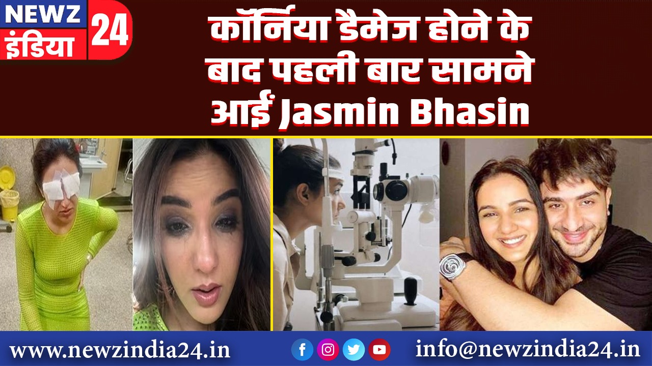 कॉर्निया डैमेज होने के बाद पहली बार सामने आईं Jasmin Bhasin