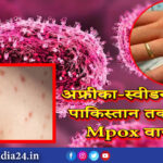 अफ्रीका-स्वीडन के बाद पाकिस्तान तक पहुंचा Mpox वायरस