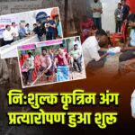 निःशुल्क कृत्रिम अंग प्रत्यारोपण हुआ शुरू 