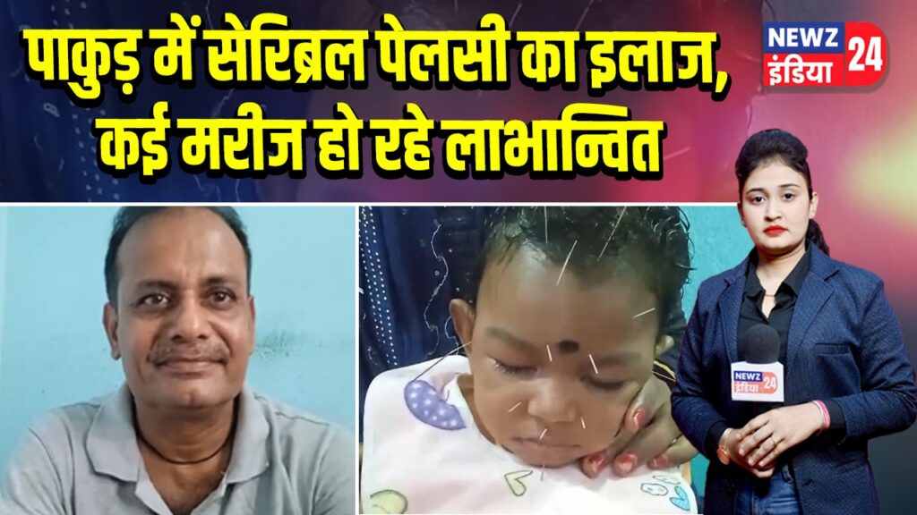 पाकुड़ में सेरिब्रल पेलसी का इलाज, कई मरीज हो रहे लाभान्वित