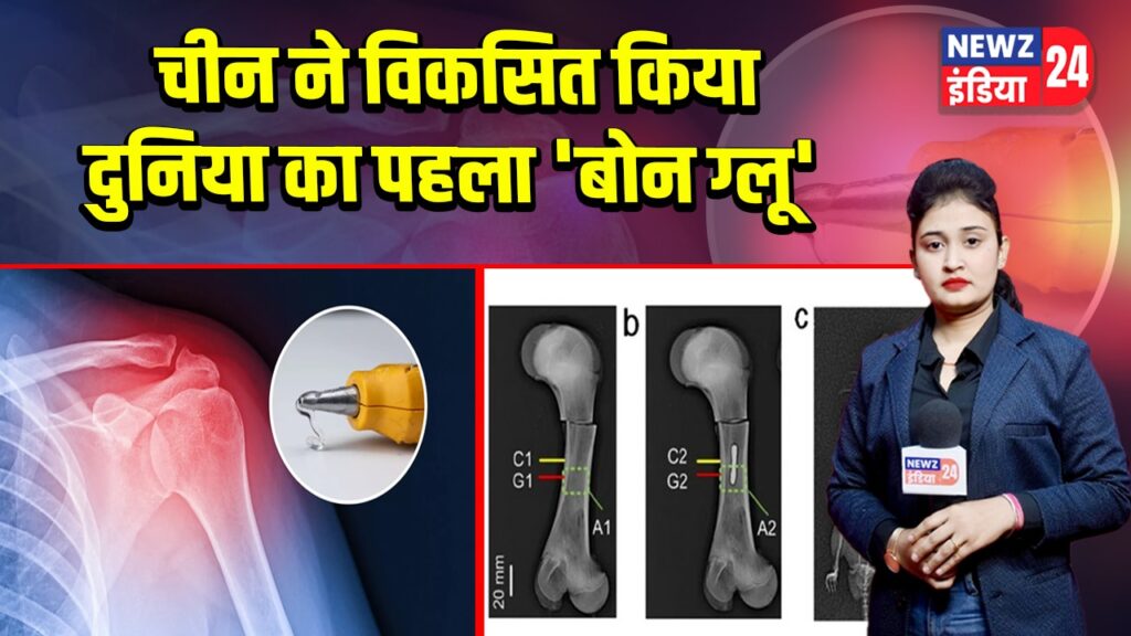 चीन ने विकसित किया दुनिया का पहला ‘बोन ग्लू’