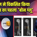 चीन ने विकसित किया दुनिया का पहला ‘बोन ग्लू’