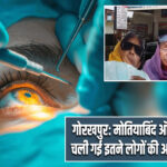 गोरखपुर: मोतियाबिंद ऑपरेशन के बाद चली गई इतने लोगों की आंखों की रोशनी