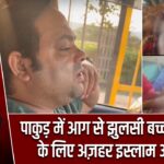 पाकुड़ में आग से झुलसी बच्ची के इलाज के लिए अज़हर इस्लाम आगे आए