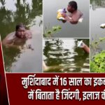 मुर्शिदाबाद में 16 साल का इकबाल तालाब में बिताता है जिंदगी, इलाज की दरकार |