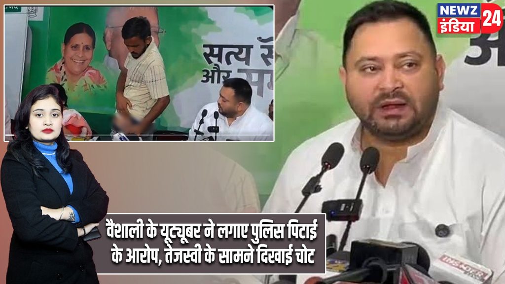 वैशाली के यूट्यूबर ने लगाए पुलिस पिटाई के आरोप, तेजस्वी के सामने दिखाई चोट |