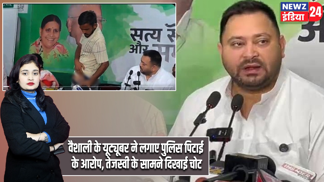 वैशाली के यूट्यूबर ने लगाए पुलिस पिटाई के आरोप, तेजस्वी के सामने दिखाई चोट |